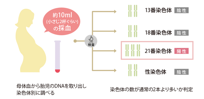 約10ml(小さじ2杯くらい)の採血を行い、母体血から胎児のDNAを取り出し染色体別に調べます。染色体の数が通常の2本より多いかどうか、判定を行います。